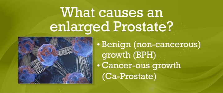 Benign Prostatitis Treatment